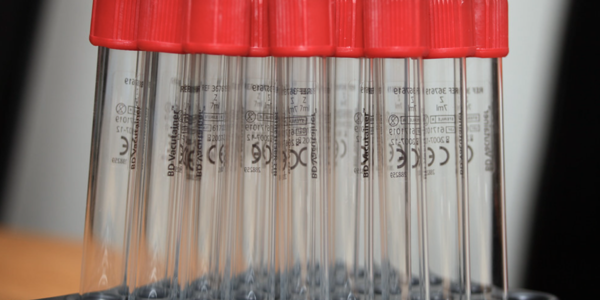 Test tubes (pixabay)